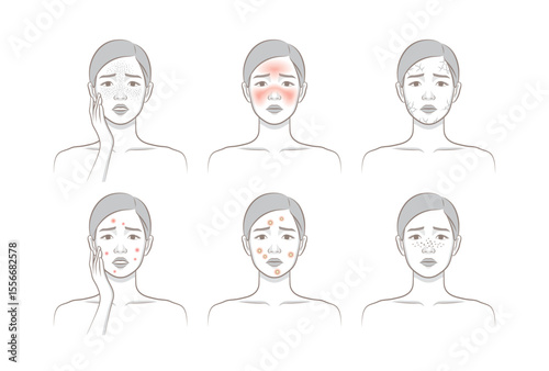 Woman's cosmetic skin trouble_Female character with freckle, blush, dryness, papule, pastule, blackhead