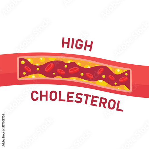 High-Cholesterol-Blood-Vector-Art 