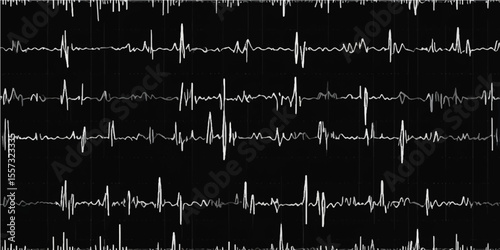 Electrocardiogram (ECG) monitor displaying a medical heartbeat pulse wave