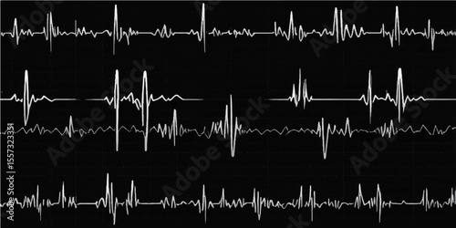 Medical heart monitor showing an electrocardiogram (ECG) heartbeat wave graph