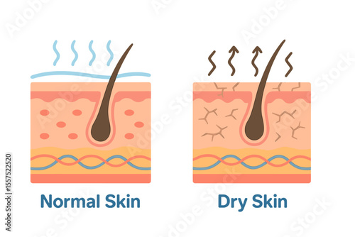 Vector diagram featuring schemes of two skin types, intended for healthcare illustrations