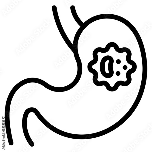 Stomatch cancer in vector illustration