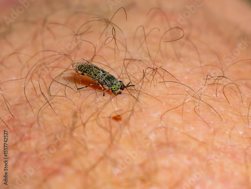 Close-up of a blood-feeding horsefly (Tabanidae) on human skin. The detailed macro shows the fly's eyes and wings during biting. Concept of insect bites, parasites, or disease vectors