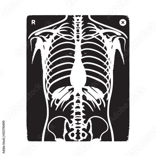 Black X-ray sheet Silhouette Vector, High Quality Illustration on White Background