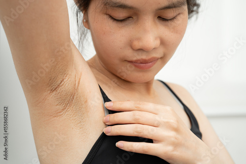 Asian woman have problem black armpit beauty skin care.