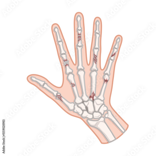 Human Hand Skeleton: A medical illustration meticulously details the skeletal structure of a human hand, showcasing its intricate network of bones and joints with precision.
