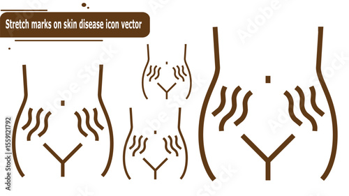 Stretch marks on skin disease icon vector