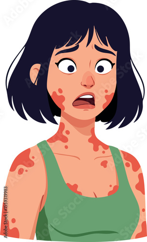 Young woman with skin rash and worried expression showing allergic reaction symptoms in green top vector illustration