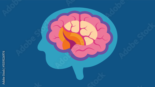 An MRI image zoomed in on the basal ganglia displaying signs of brain tissue loss and degeneration common in Parkinsons disease.. Vector illustration