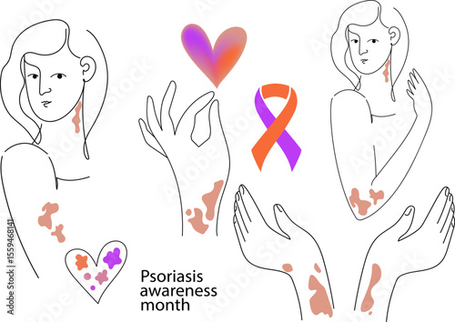 Psoriasis awareness month concept with woman having skin patches. Health month. Global skin disorder awareness. International disease concept.Linear  png vector illustration.
