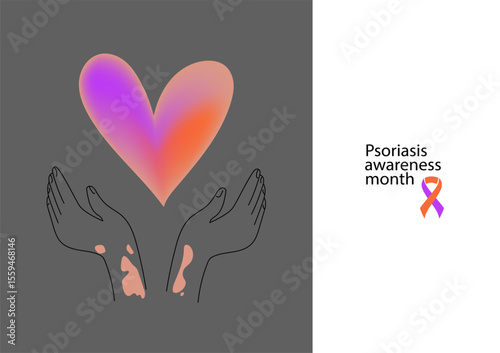 Human hands with symptoms of psoriasis on her skin, banner for Psoriasis awareness month.  Linear  vector illustration.