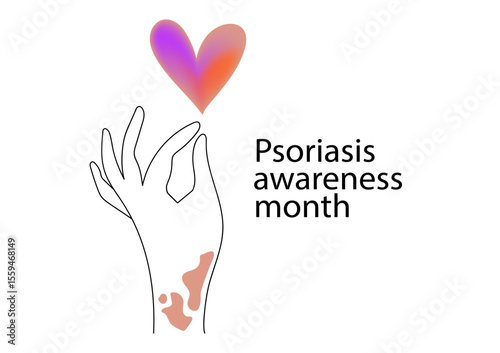Human hands with symptoms of psoriasis on her skin, banner for Psoriasis awareness month.  Linear  vector illustration.