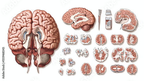 Autism Puzzle Brains Vector Illustration