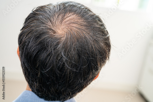 Bald in the middle head and begin no loss hair glabrous of mature Asian business smart active office man.