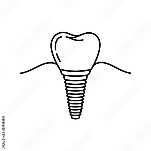 Dental Implant Line Art Illustration for Dentistry and Oral Health