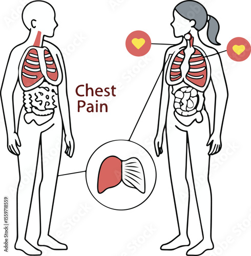Detailed flat vector illustration of internal organs experiencing chest pain isolated on transparent background