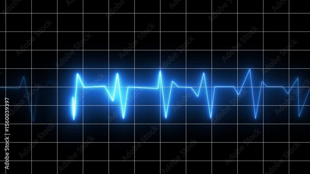 EKG Heartbeat reading animation on black background in 4K. Cardiogram nubes rate ecg waveform surger, Medical monitor displaying cardiography pulse checkup diagnosis electronic screen display machine.
