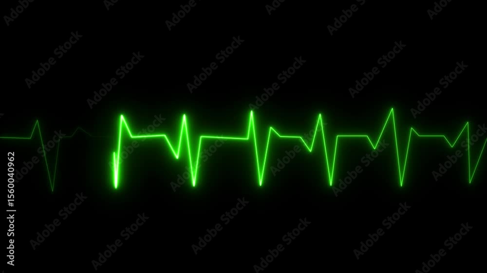 EKG Heartbeat reading animation on black background in 4K. Cardiogram nubes rate ecg waveform surger, Medical monitor displaying cardiography pulse checkup diagnosis electronic screen display machine.