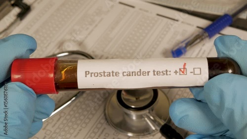 Doctor showing positive prostate cancer test result
