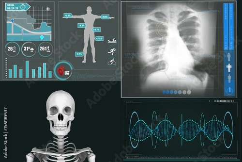 Human skeleton with various medical xray reports