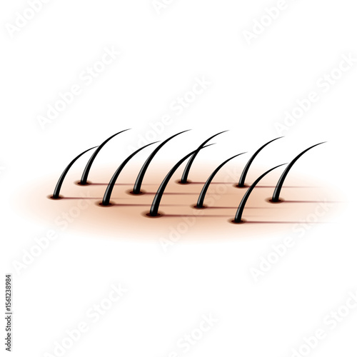 Growing black human hair close-up realistic 3d vector illustration emerging from skin, for dermatology, trichology, cosmetic depilatories, hair transplantation, medical poster or banner design.