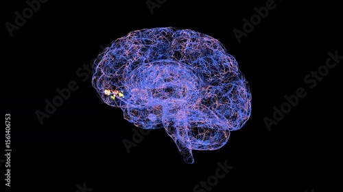 Migraine in right orbitofrontal cortex, conceptual animation