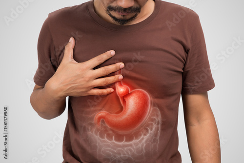 A Hiatal Hernia is illustrated with a line drawing showing the body’s internal symptom part of the stomach pushing through the diaphragm into the chest cavity. Stomachache.
