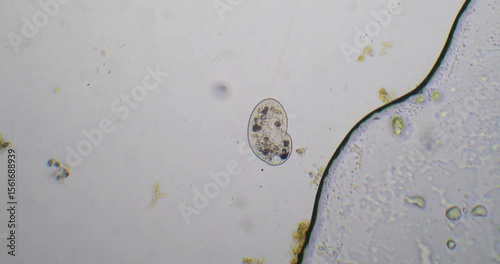 Paramecium aurelia moving in pond water sample