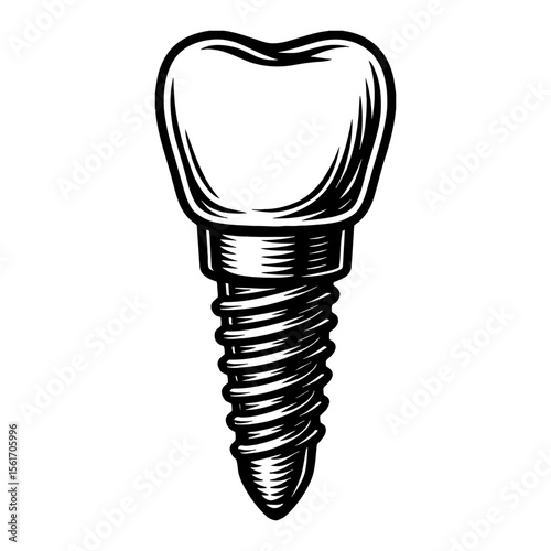 Dental Implant Screw Black and White Outline Line Art Drawing for Orthodontics and Medical Use
