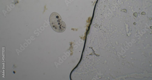 Paramecium aurelia moving near organic debris