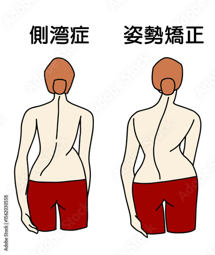 S字側湾症の姿勢を背中から見た時の女性イラスト