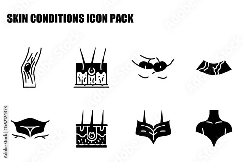 Skin conditions icon set with various types of skin lesions and inflammation. Illustrations of dermatological conditions displayed in a flat, vector style for educational purposes.