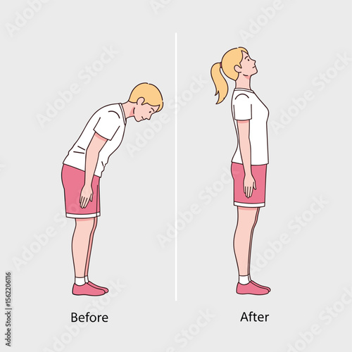 Before and After Posture Comparison, Correcting Posture Illustration, Health and Wellness Concept