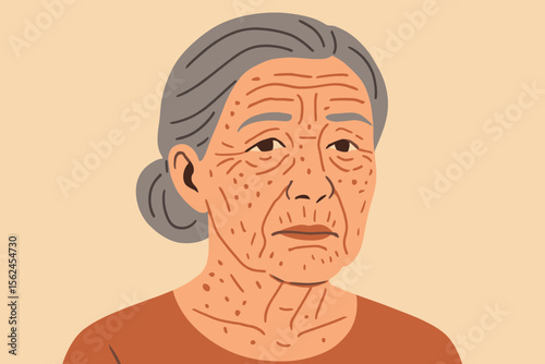 Elderly Woman Aging Skin Wrinkles Neck Spots. Senior Female Portrait Gray Hair Bun. Dermatology Skin Imperfections. Mature Age Illustration. Health Care, Beauty, Aging Process Concept Vector
