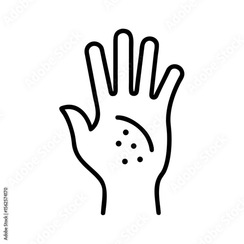 Hand with contact dermatitis showing red spots in outline style  