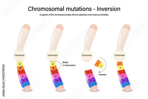 Inversion. Chromosomal mutations. Various genetic disorders. Alteration of chromosome structure. Vector used for scientific and medical education. 