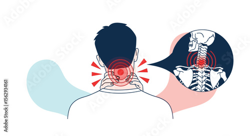 Neck pain causes symptoms treatments and prevention guide explained