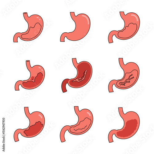 Understanding Stomach Anatomy A Visual Guide to Stomach Shapes and Conditions