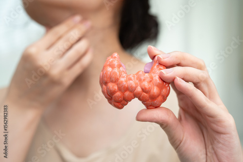 Hyperthyroidism, Overactive Thyroid, Thyroid Lymphoma, Asian woman with thyroid gland human anatomy model.