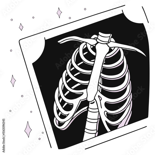 X-ray image of ribcage with glowing outline on dark background  