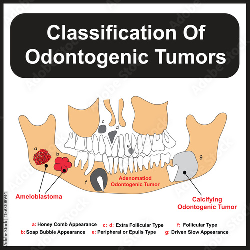Classification of Odontogenic Tumors Diagram