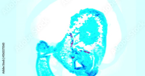 MRI brain scan with color highlights  offering detailed insights into blood flow and brain function. Essential for accurate diagnosis and treatment planning.