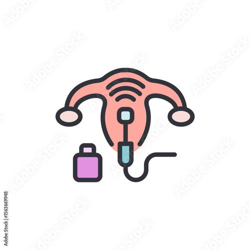 Illustration Of Intrauterine Insemination Process On A Transparent Backdrop