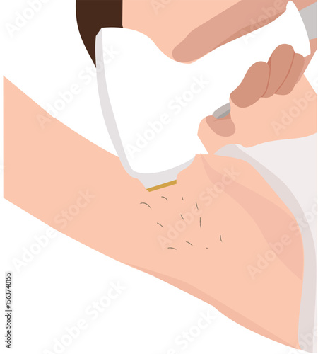 women laser armpit. Laser hair removal. Woman hairy armpits and bikini area