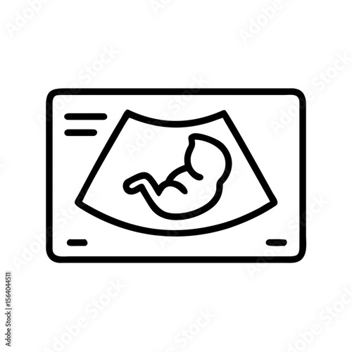 Pregnancy ultrasound screen with fetus image — OB/GYN diagnostics, transparent background