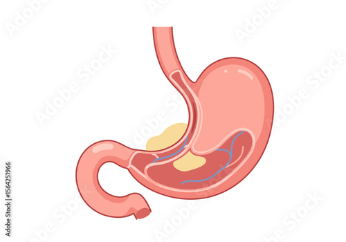 Anatomical Illustration of a Human Stomach with Veins and Contents.