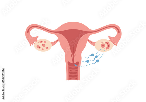 Female Reproductive System Illustration with Uterus Ovaries and Sperm Cells.