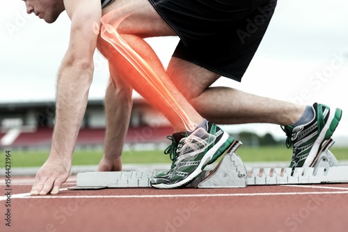 Runner experiencing leg pain