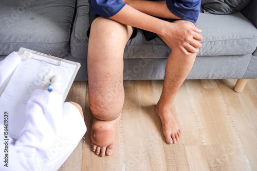 Doctor Checking Lymphatic Filariasis Patient