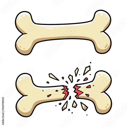"Cartoon Bone and Broken Bone Vector Illustration – Fracture Concept Clipart"


